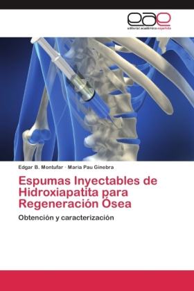 Espumas Inyectables de Hidroxiapatita para Regeneración Ósea