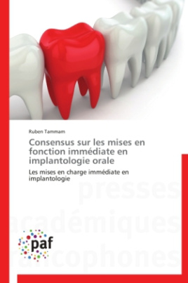 Consensus sur les mises en fonction immédiate en implantologie orale