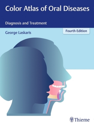 Color Atlas of Oral Diseases