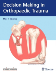 Decision Making in Orthopaedic Trauma