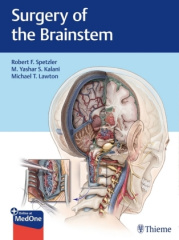 Surgery of the Brainstem